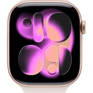 Apple  Watch – 1